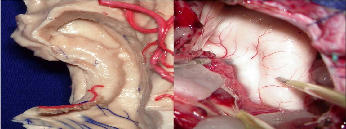 Neuro Clínica